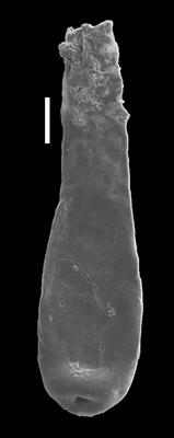 <i><i>Clavachitina</i> | Clavachitina sp.</i><br />Likenai 396 borehole, 823.26 m, Pirgu Stage (884-9)