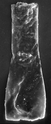 <i><i>Chitinozoa</i> | Vitreachitina sp. 3 Nestor, 1994</i><br />Nagli 106 borehole, 633.10 m, Adavere Stage (272-197)