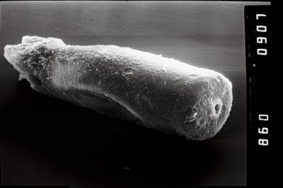 <i><i>Conochitina</i> | Conochitina sp.</i><br />Ikla borehole, 326.67 m, Raikküla Stage (754-1011)