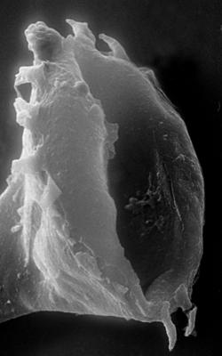 <i><i>Chitinozoa</i> | Clathrochitina aff. clathrata Eisenack, 1959</i><br />Nagli 106 borehole, 613.50 m, Adavere Stage (272-58)