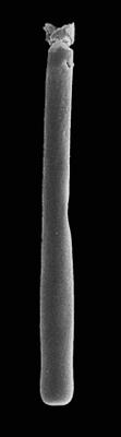 <i><i>Rhabdochitina gracilis</i></i><br />Kerguta 565 borehole, 174.48 m, Lasnamägi Stage (544-19)
