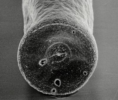 <i><i>Chitinozoa</i> | Conochitina cf. elegans Eisenack, 1931</i><br />Hullo 385 borehole, 25.50 m, Vormsi Stage (306-12)