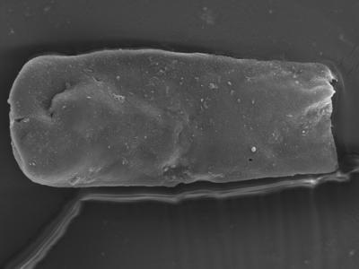 <i><i>Conochitina</i> | Conochitina sp. (kitsas)</i><br />Ohesaare borehole, 162.90 m, Jaagarahu Stage (754-328)